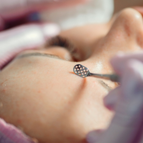 Чистка лица